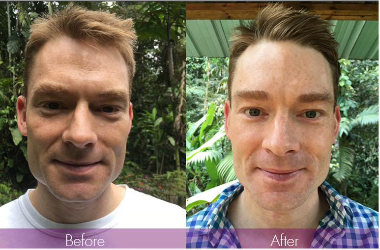 Yoga retreat before and after